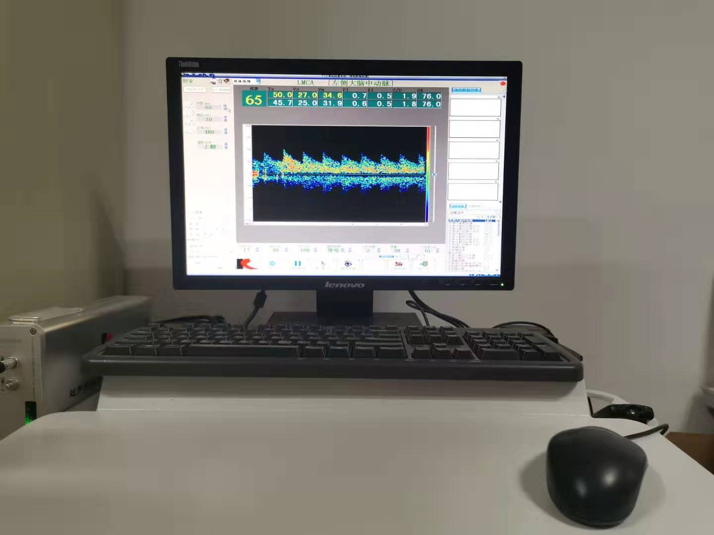 超声经颅多普勒血流分析仪