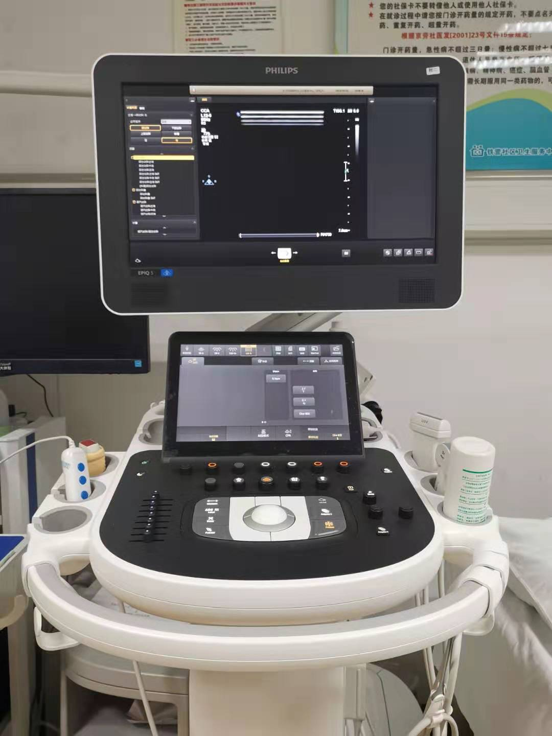 全数字化高端彩色多普勒超声诊断仪